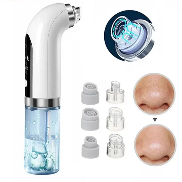 Blackhead Remover