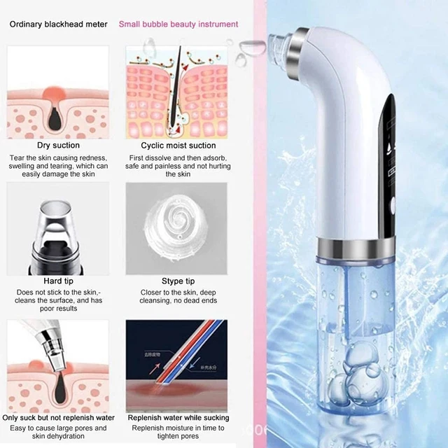 Blackhead Remover