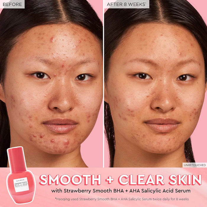 Glow Recipe -
Strawberry Smooth BHA + AHA Salicylic Acid Serum