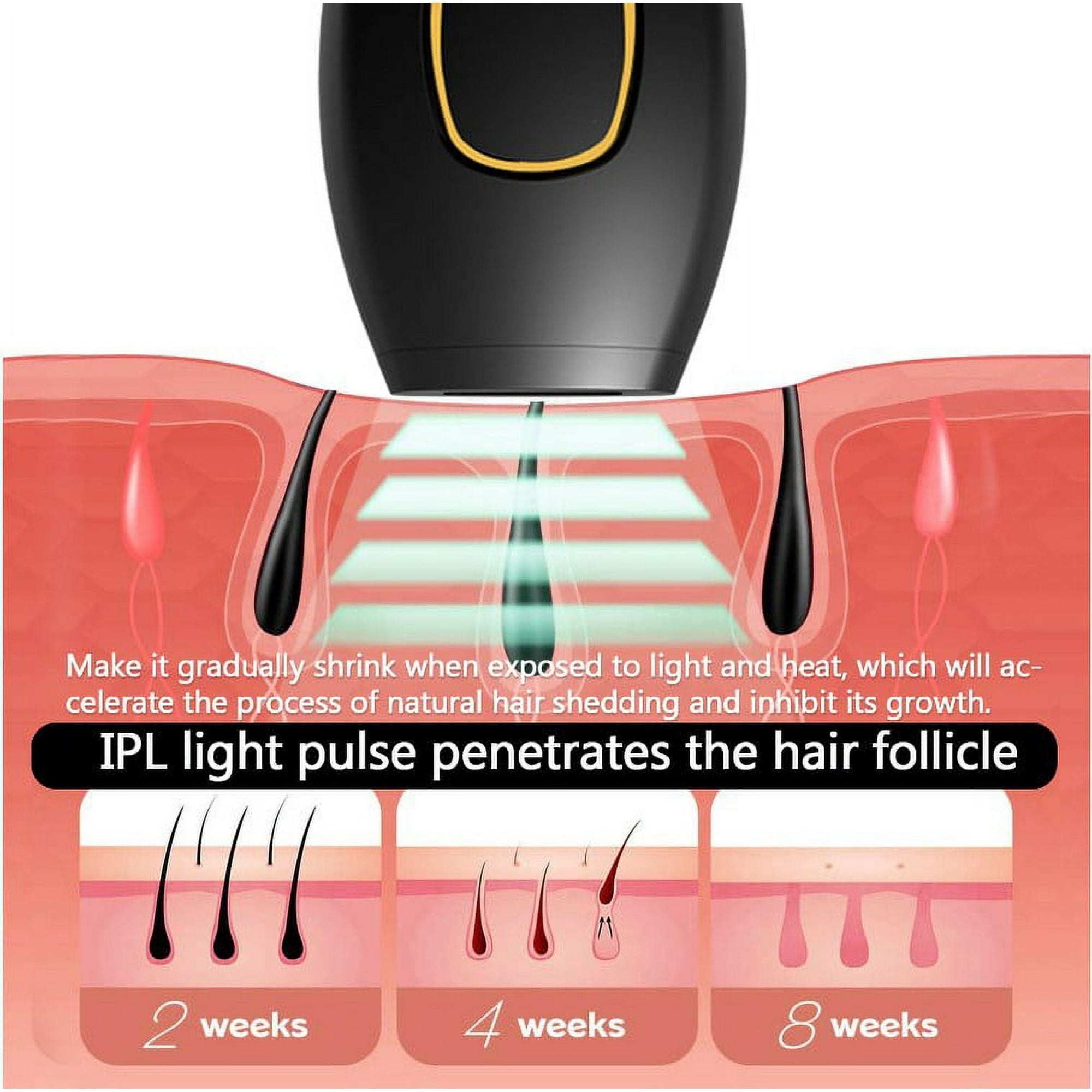 IPL - Laser Hair Removal at Home