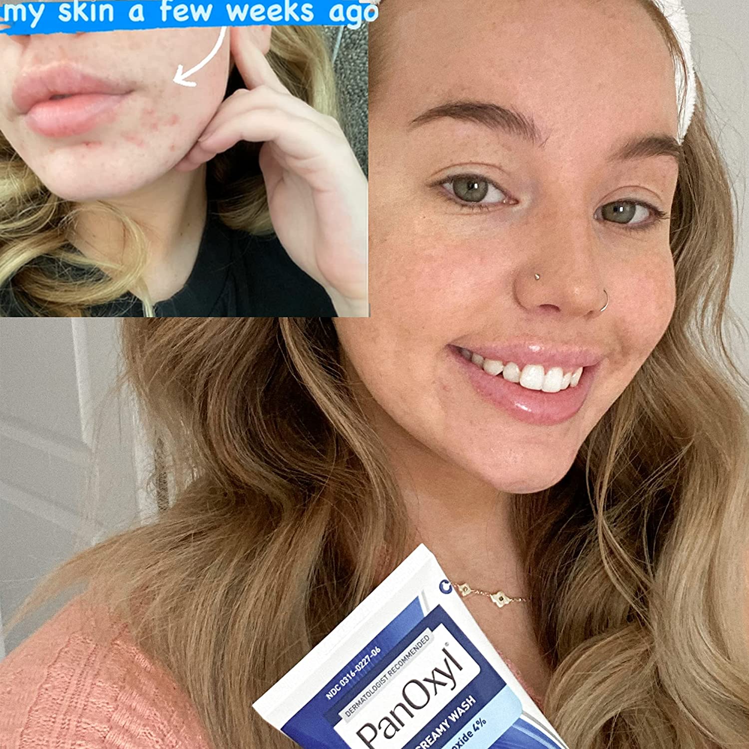 PANOXYL - Acne Creamy Wash Benzoyl Peroxide 4% Daily Control