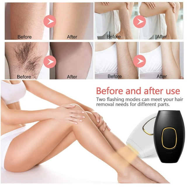 IPL - Laser Hair Removal at Home