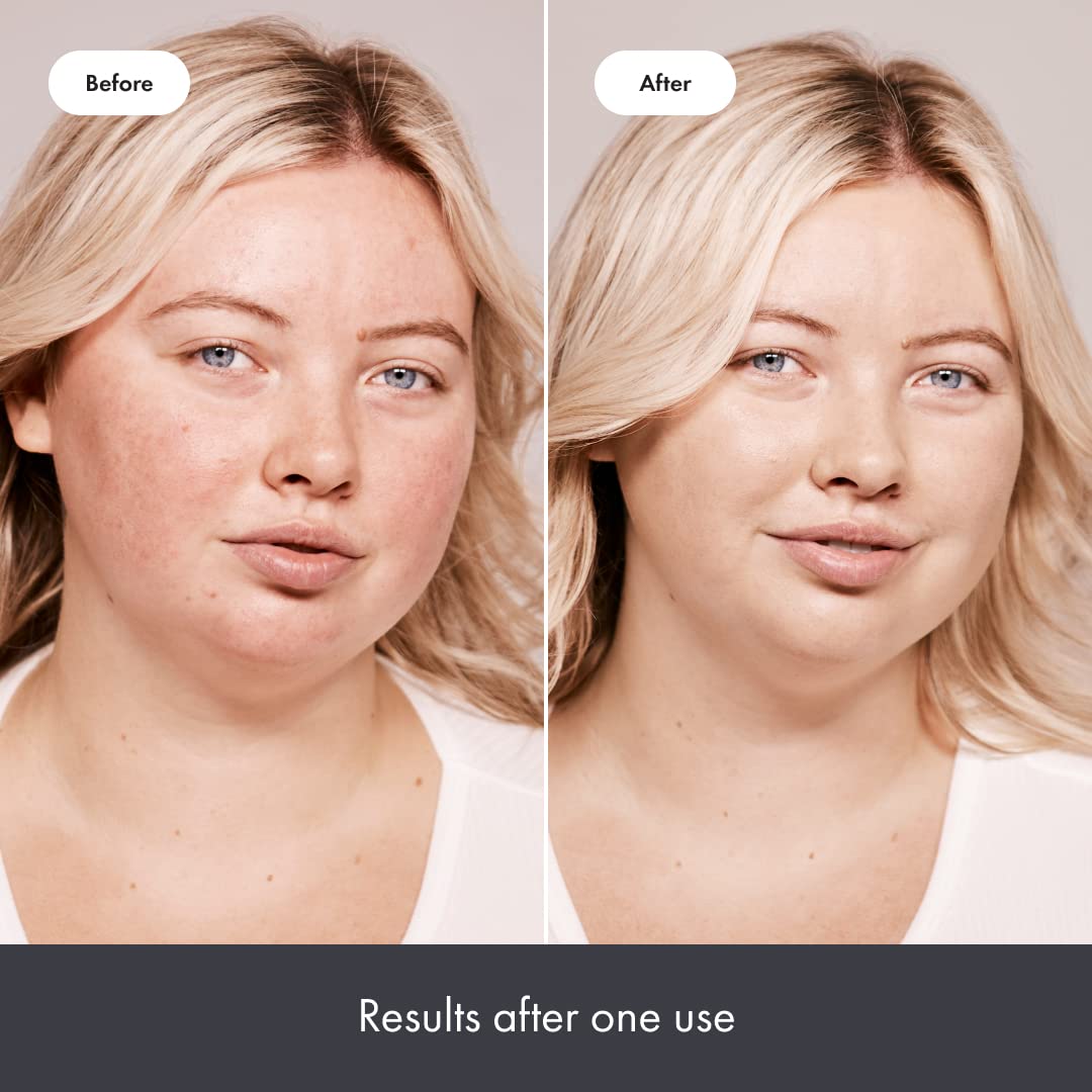 HERO - Rescue Balm +Red Correct